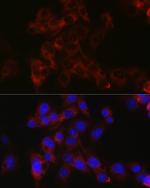 Apolipoprotein B Polyclonal Antibody