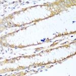 MYH9 Polyclonal Antibody