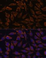 NOTCH2 Polyclonal Antibody