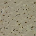 NFkB p52/p100 Polyclonal Antibody