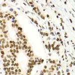 NFkB p52/p100 Antibody in Immunohistochemistry (Paraffin) (IHC (P))