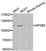 NFkB p52/p100 Antibody in Western Blot (WB)