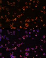 CD39 Polyclonal Antibody