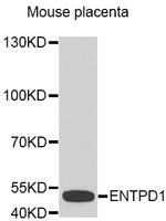 CD39 Antibody in Western Blot (WB)