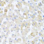 Centrin 1 Polyclonal Antibody