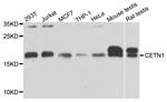 Centrin 1 Antibody in Western Blot (WB)