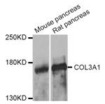 Collagen III Antibody in Western Blot (WB)