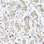 Carboxypeptidase A1 Polyclonal Antibody