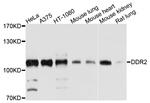 DDR2 Polyclonal Antibody