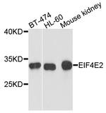 eIF4E2 Antibody in Western Blot (WB)