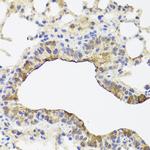 TOMM34 Polyclonal Antibody