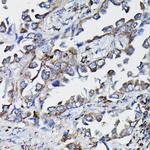 GSTK1 Antibody in Immunohistochemistry (Paraffin) (IHC (P))