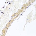 CD81 Antibody in Immunohistochemistry (Paraffin) (IHC (P))