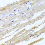 BNIP3 Antibody in Immunohistochemistry (Paraffin) (IHC (P))