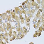 BNIP3 Polyclonal Antibody