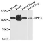 CPT1B Polyclonal Antibody
