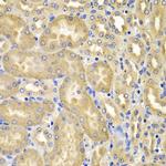 XIAP Polyclonal Antibody