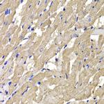 MPI Polyclonal Antibody