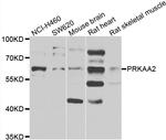 AMPK alpha-2 Antibody in Western Blot (WB)