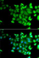 TET3 Antibody in Western Blot (WB)