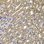 Cyclin A2 Polyclonal Antibody