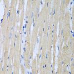CSF3R Polyclonal Antibody