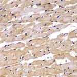 PSEN2 Antibody in Immunohistochemistry (Paraffin) (IHC (P))