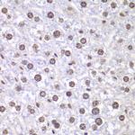 TOP1 Polyclonal Antibody