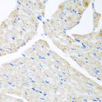 GABARAPL2 Polyclonal Antibody