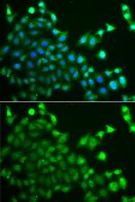 CBLC Polyclonal Antibody