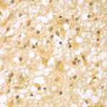 PAK6 Polyclonal Antibody