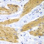 H-Ras Polyclonal Antibody
