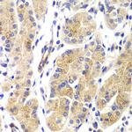 H-Ras Antibody in Immunohistochemistry (Paraffin) (IHC (P))