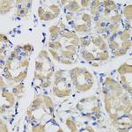 PSPH Polyclonal Antibody