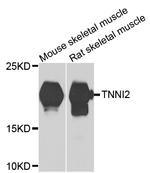 TNNI2 Polyclonal Antibody