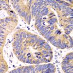 HMGCL Antibody in Immunohistochemistry (Paraffin) (IHC (P))