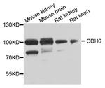 K-cadherin Antibody in Western Blot (WB)