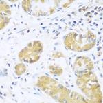 UCHL3 Polyclonal Antibody