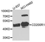 CD200R Polyclonal Antibody