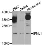 IL-29 Antibody in Western Blot (WB)