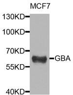 GBA Polyclonal Antibody