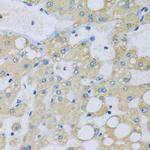 NDUFA7 Polyclonal Antibody