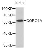 Coronin 1A Antibody in Western Blot (WB)
