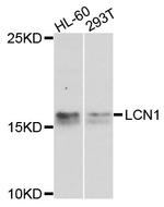 LCN1 Antibody in Western Blot (WB)