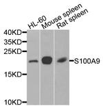 S100A9 Polyclonal Antibody