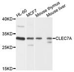 CD369 (Clec7a, Dectin-1) Polyclonal Antibody