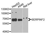 SERPINF2 Antibody in Western Blot (WB)