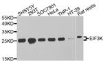 eIF3k Antibody in Western Blot (WB)
