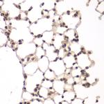 VRK1 Antibody in Immunohistochemistry (Paraffin) (IHC (P))