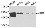 VRK1 Antibody in Western Blot (WB)
